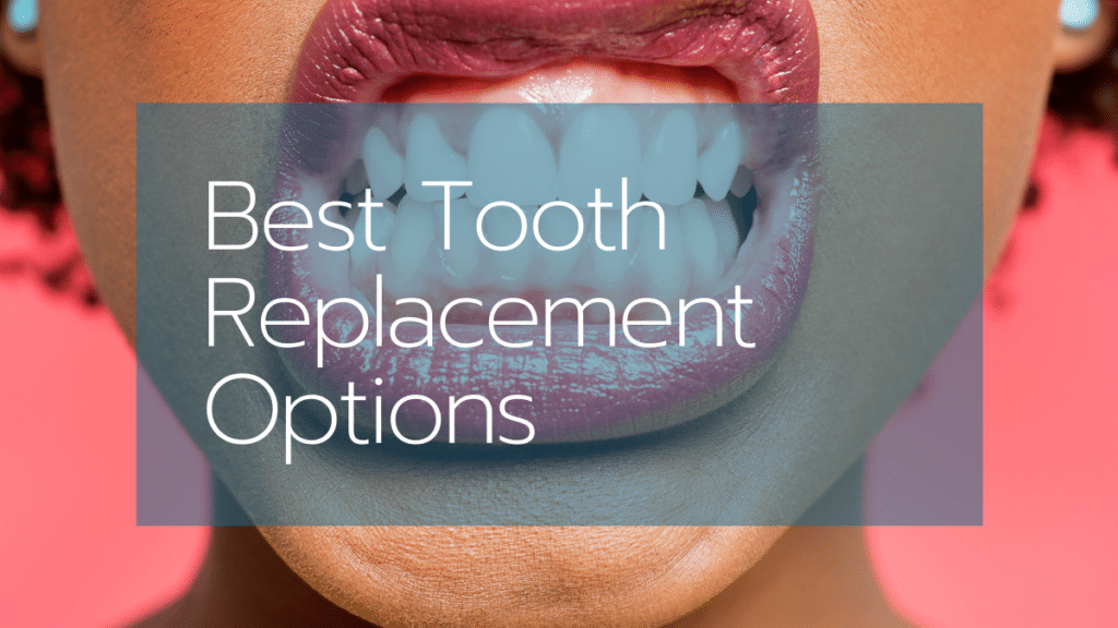 Temporary Tooth Replacement Options