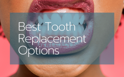 The 7 Best Tooth Replacement Options