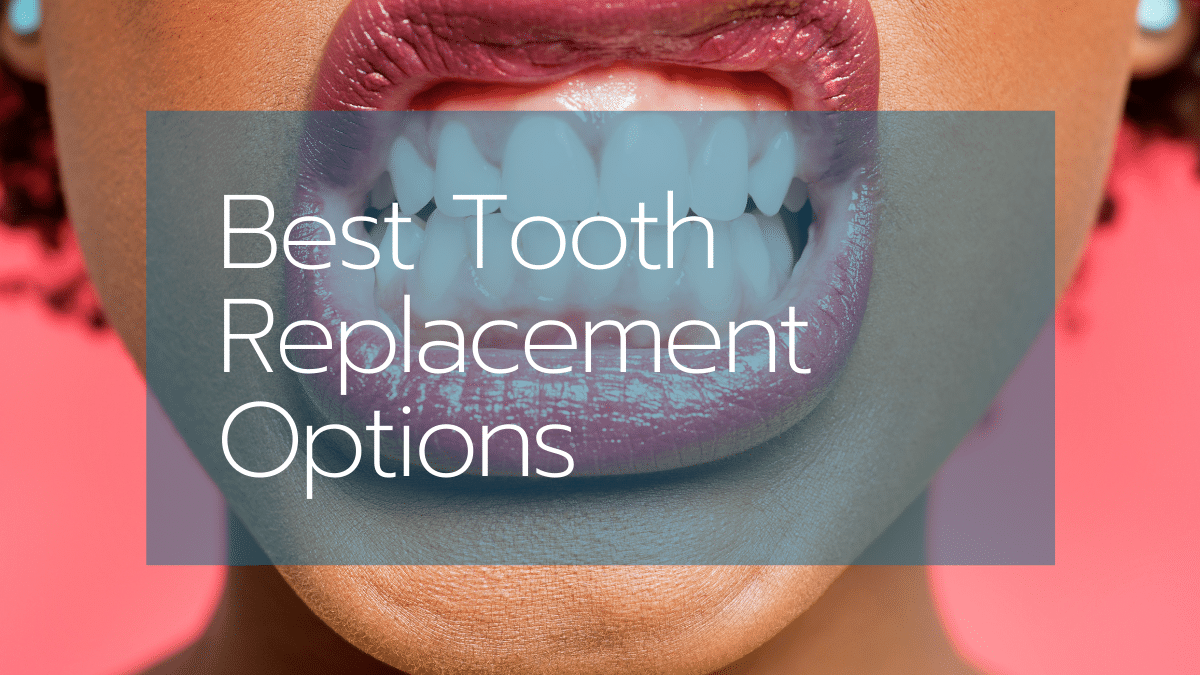 The 7 Best Tooth Replacement Options [Jul 2021] Reviews & Buying Guide